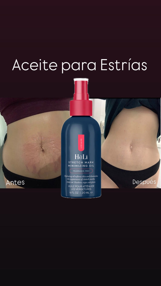 Strech Mark Oil